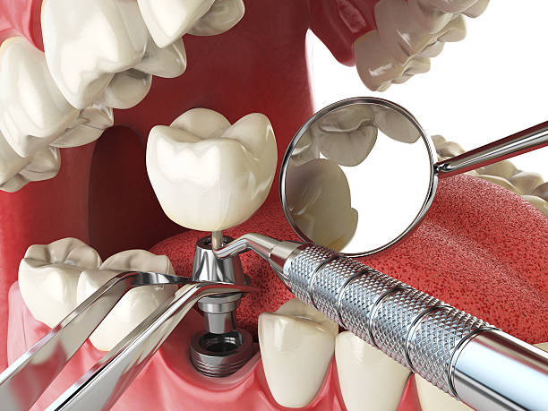 Best Orthodontic Emergency Dentist in Hernando, MS